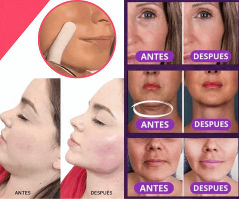 Image of MASAJEADOR FACIAL REDUCTOR DE PAPADA